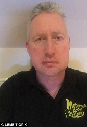 Pictured, Lembit Opik's swollen jaw after he endured five hours of painful surgery